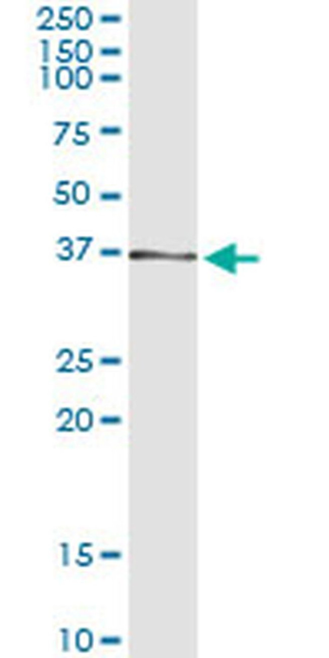 AKR7A2 Antibody in Immunoprecipitation (IP)