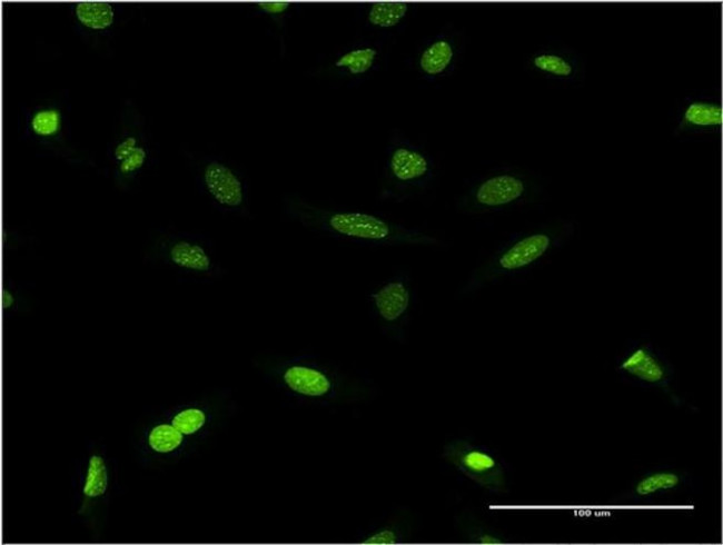 HP1 beta Antibody in Immunocytochemistry (ICC/IF)