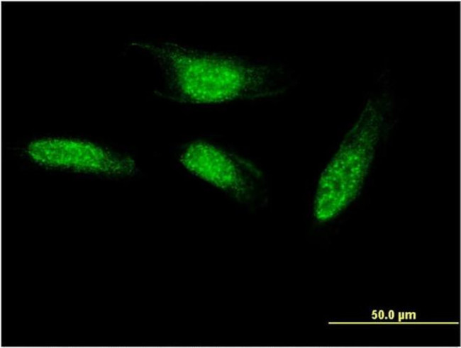 SEC14L2 Antibody in Immunocytochemistry (ICC/IF)