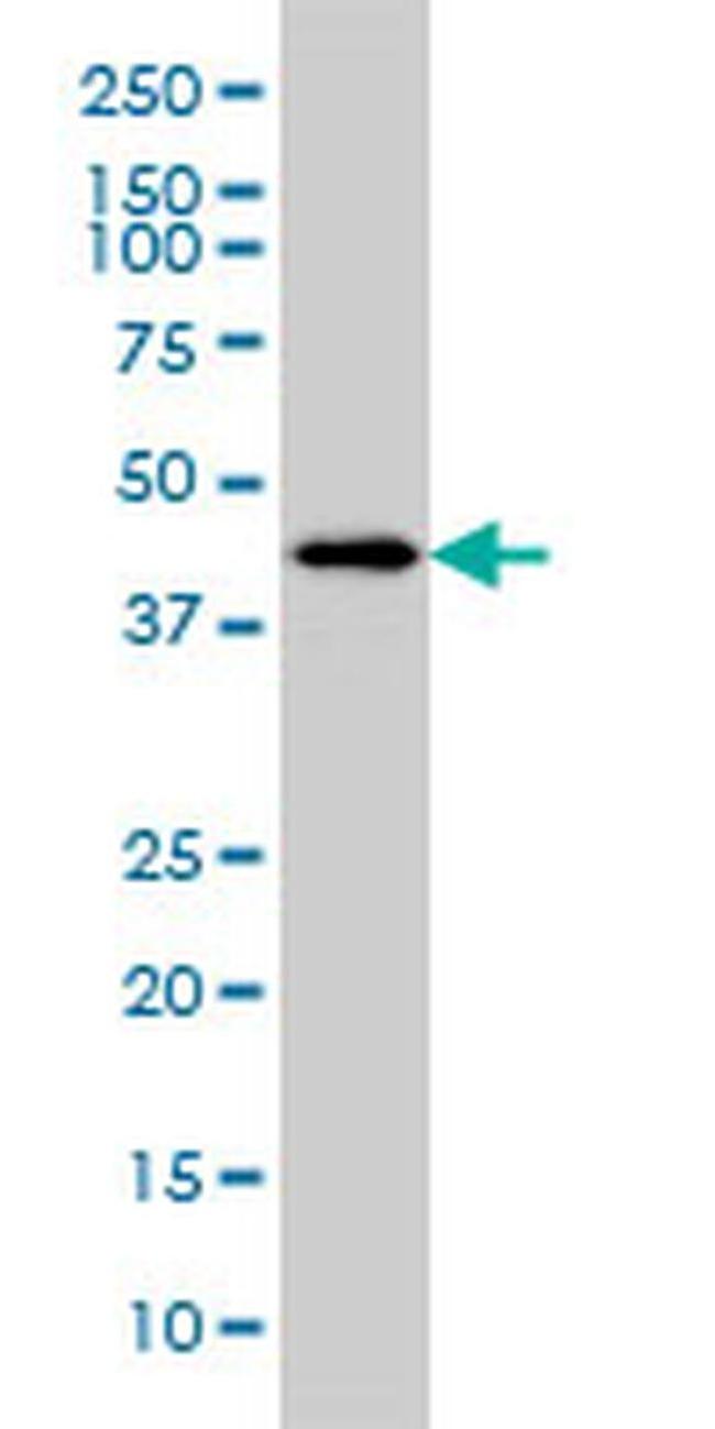 HSFX1 Antibody in Western Blot (WB)