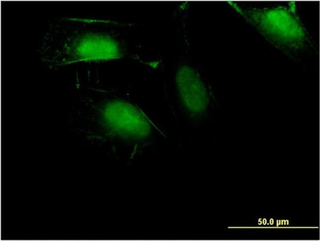 ZNF598 Antibody in Immunocytochemistry (ICC/IF)