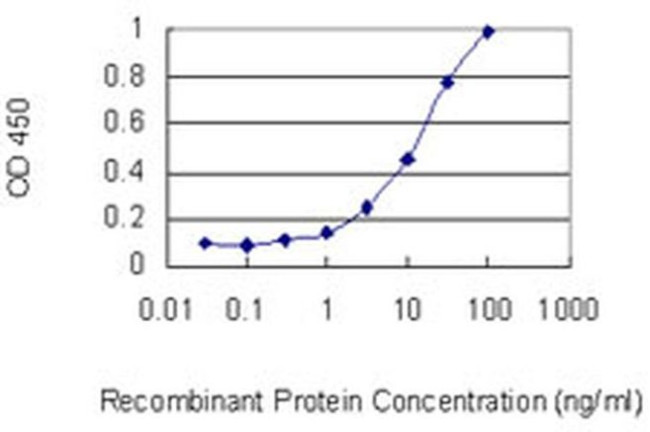 CATIP Antibody in ELISA (ELISA)