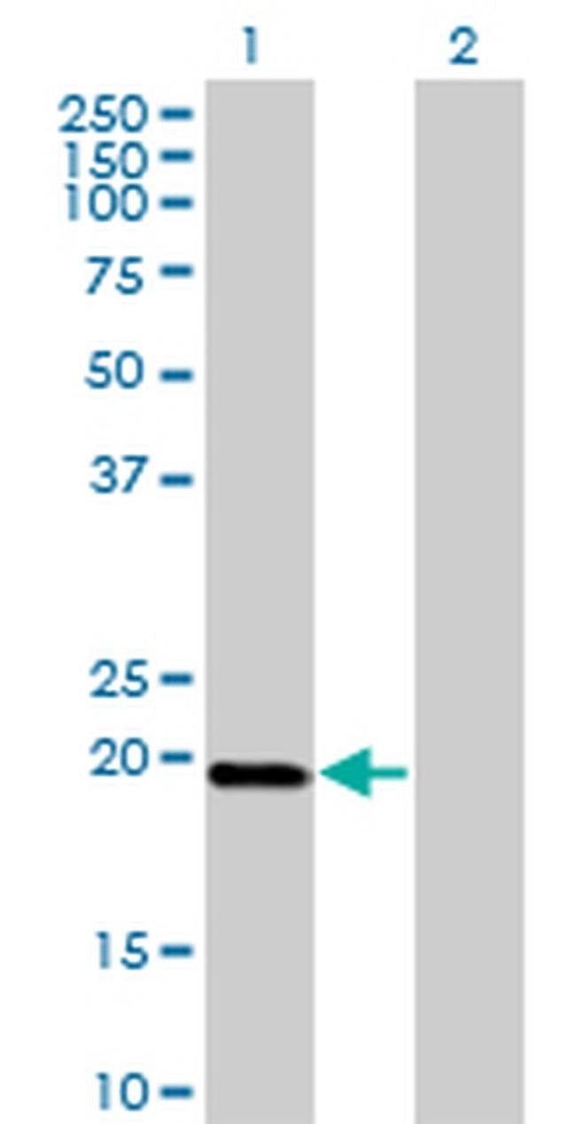 DUX3 Antibody in Western Blot (WB)