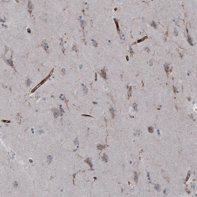 VISTA Antibody in Immunohistochemistry (IHC)