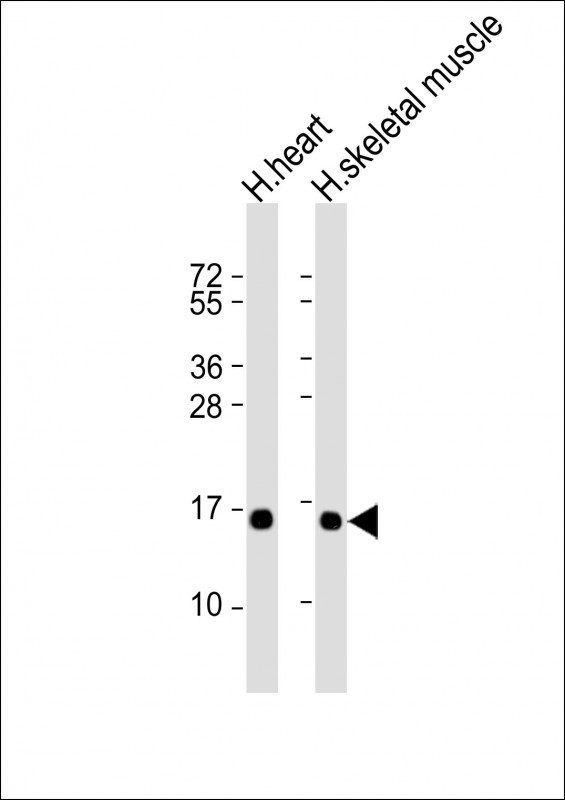 TUSC2 Antibody in Western Blot (WB)