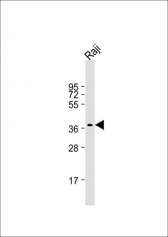 RASSF2 Antibody in Western Blot (WB)