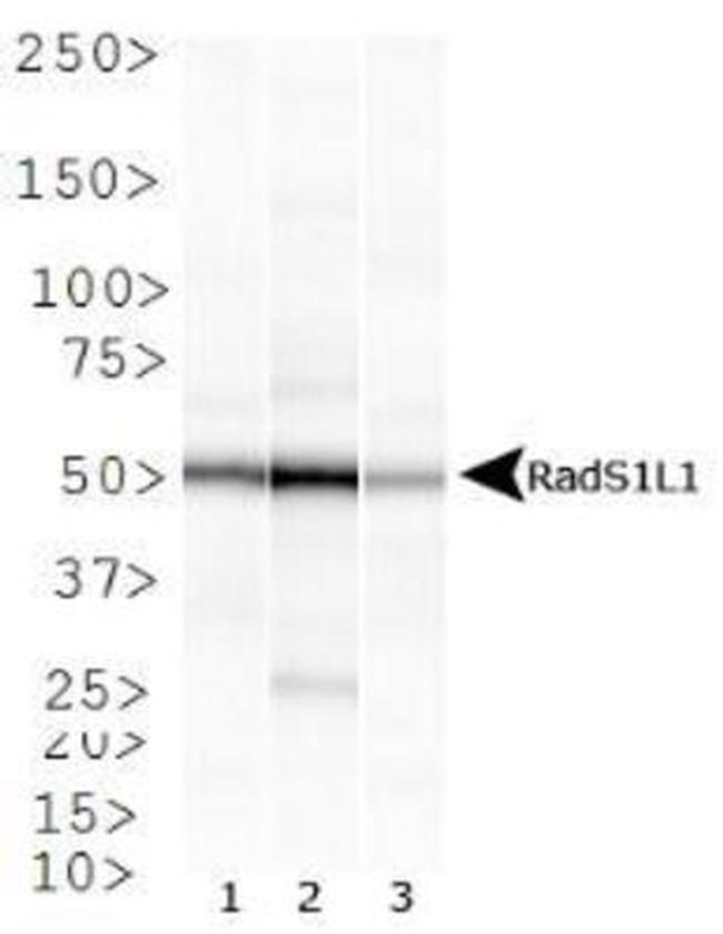 RAD51B Antibody in Western Blot (WB)