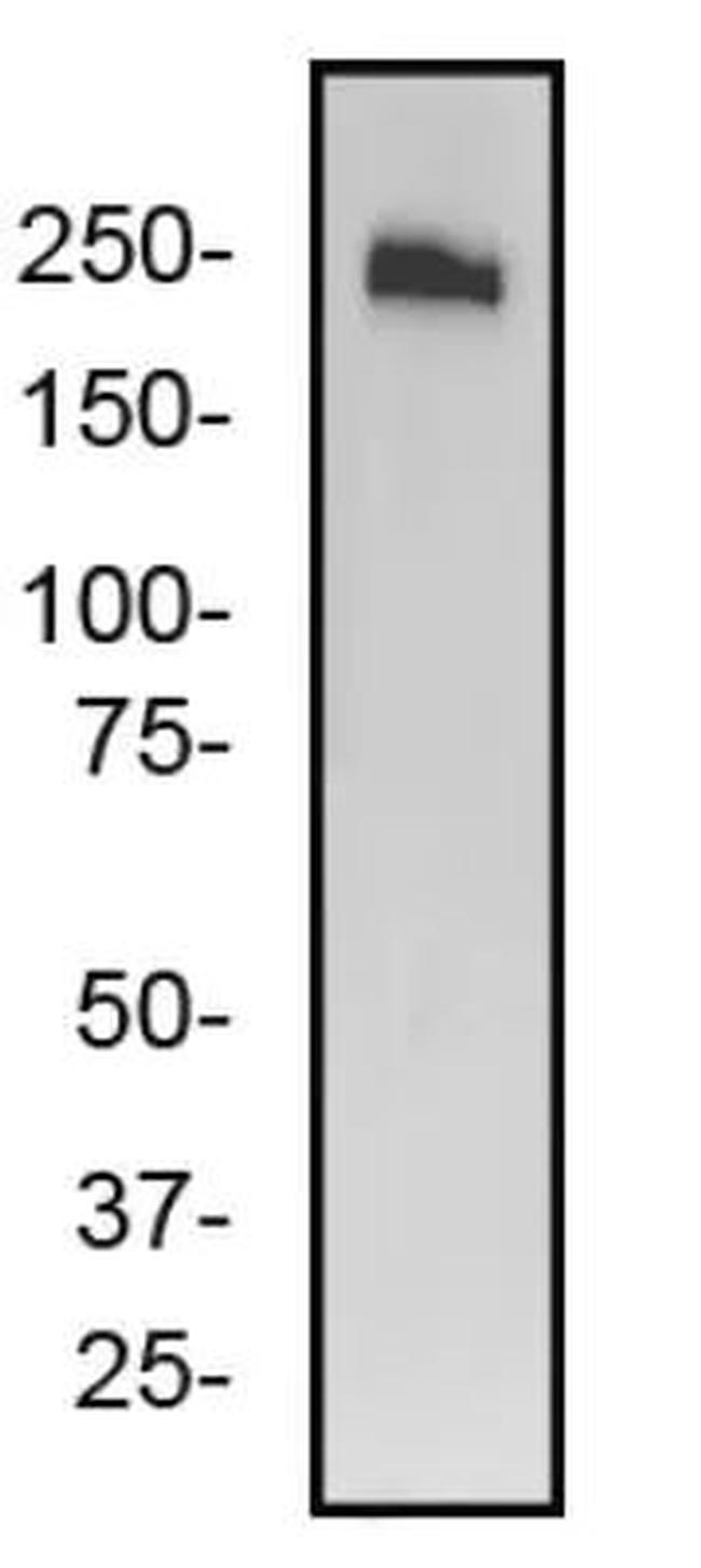 ABCA7 Antibody in Western Blot (WB)