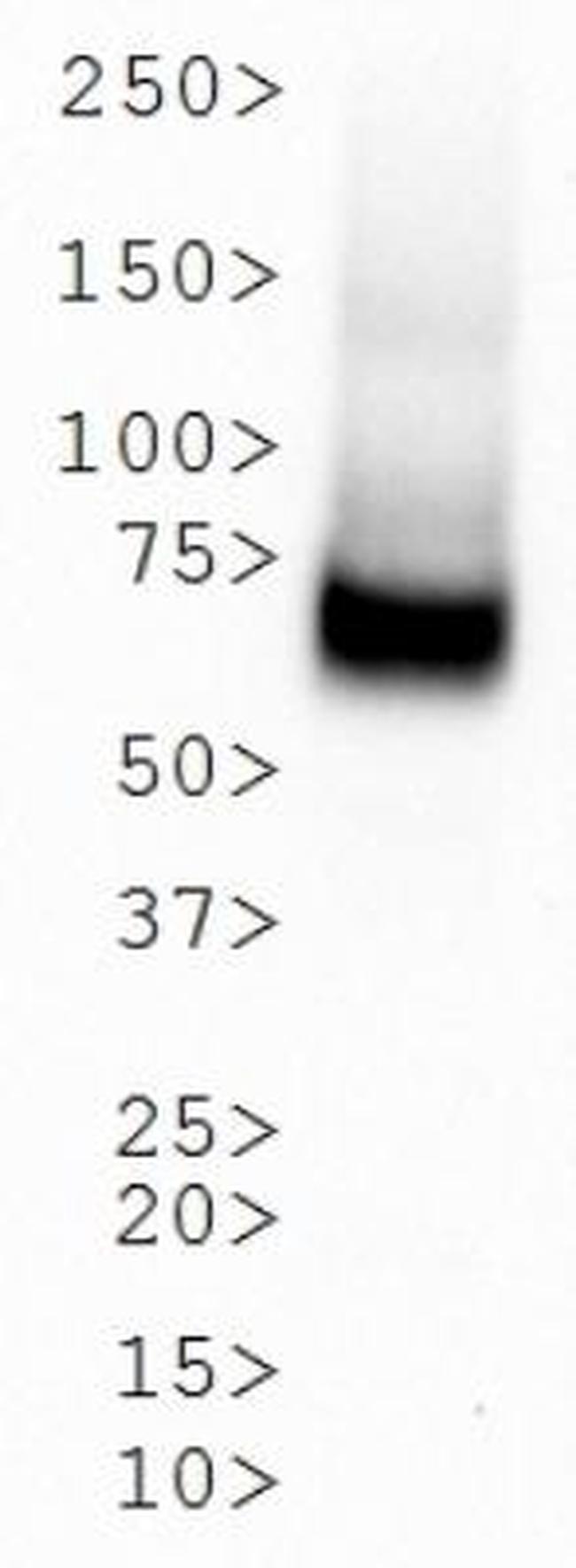 Dopamine Transporter Antibody in Western Blot (WB)