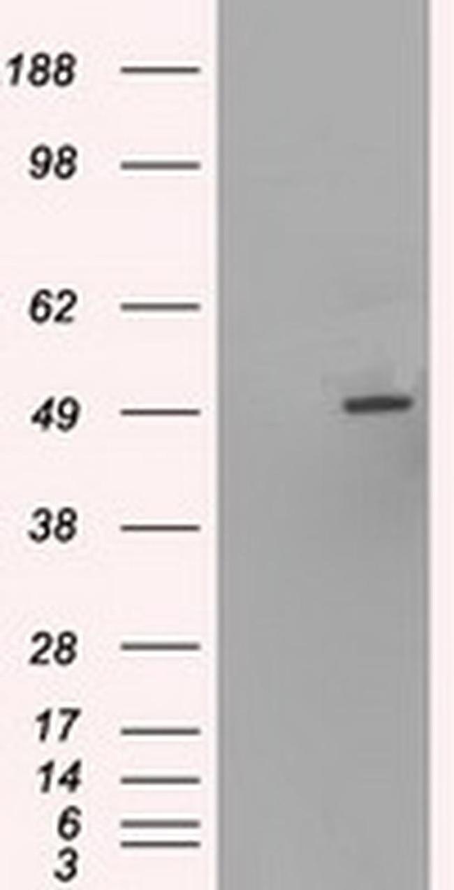 HNF6 Antibody in Western Blot (WB)