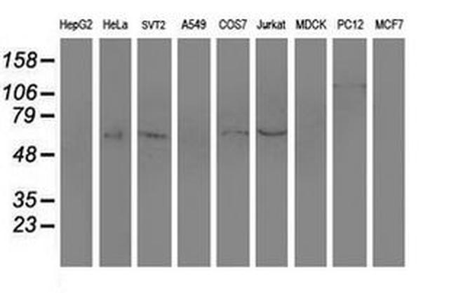 SLC7A8 Antibody in Western Blot (WB)