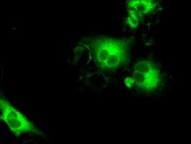 SLC7A8 Antibody in Immunocytochemistry (ICC/IF)