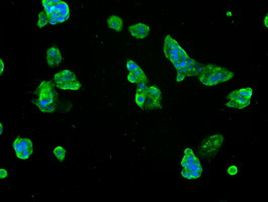 SLC7A8 Antibody in Immunocytochemistry (ICC/IF)