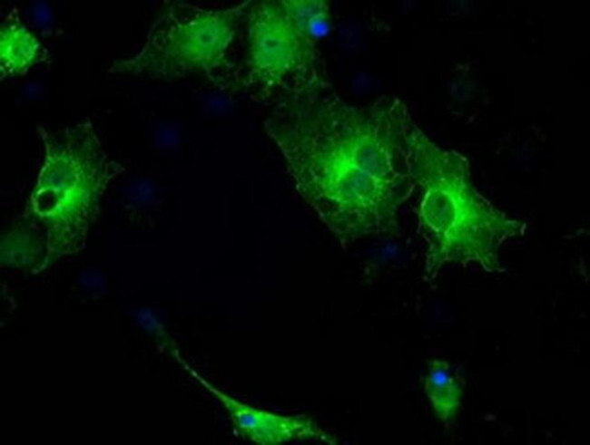 GBP2 Antibody in Immunocytochemistry (ICC/IF)