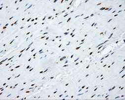 SHC Antibody in Immunohistochemistry (Paraffin) (IHC (P))