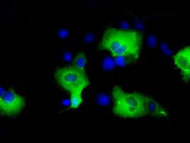 SHC Antibody in Immunocytochemistry (ICC/IF)