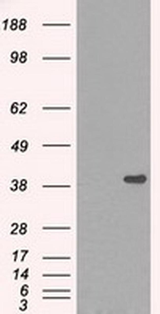 DNTTIP1 Antibody in Western Blot (WB)
