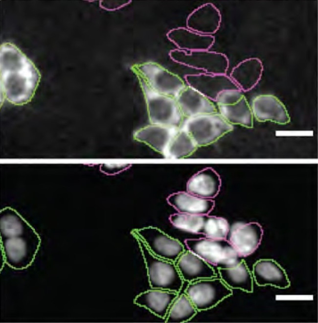 Profilin 1 Antibody in Immunocytochemistry (ICC/IF)