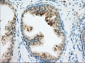 RAB17 Antibody in Immunohistochemistry (Paraffin) (IHC (P))