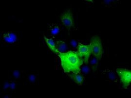 SNX9 Antibody in Immunocytochemistry (ICC/IF)