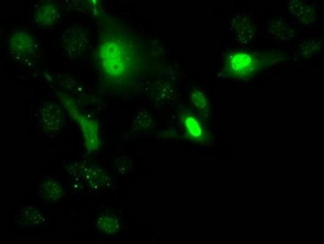 UCK1 Antibody in Immunocytochemistry (ICC/IF)