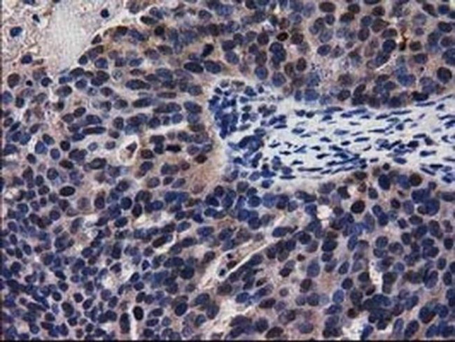 ADSL Antibody in Immunohistochemistry (Paraffin) (IHC (P))