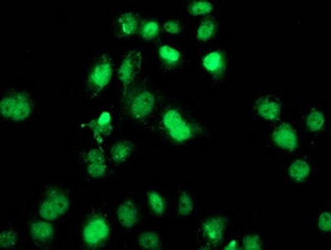 SAMHD1 Antibody in Immunocytochemistry (ICC/IF)