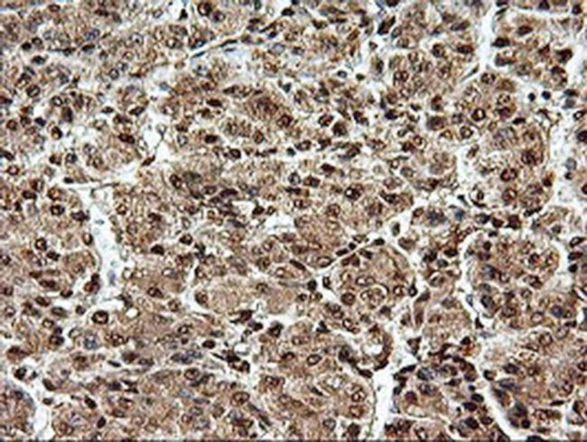 SAMHD1 Antibody in Immunohistochemistry (Paraffin) (IHC (P))