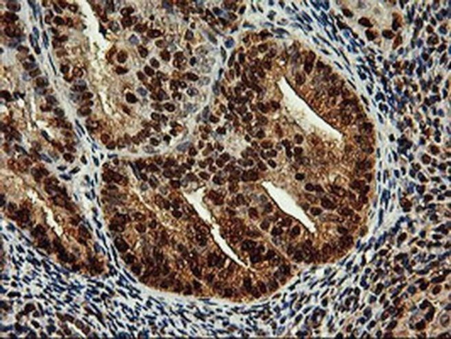 SAMHD1 Antibody in Immunohistochemistry (Paraffin) (IHC (P))