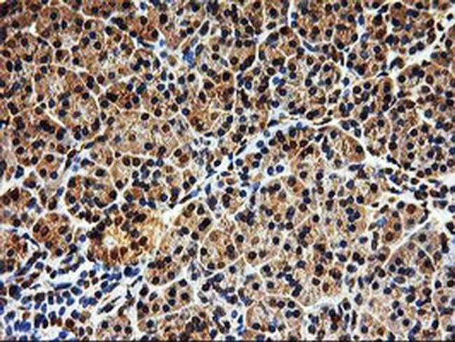 SAMHD1 Antibody in Immunohistochemistry (Paraffin) (IHC (P))