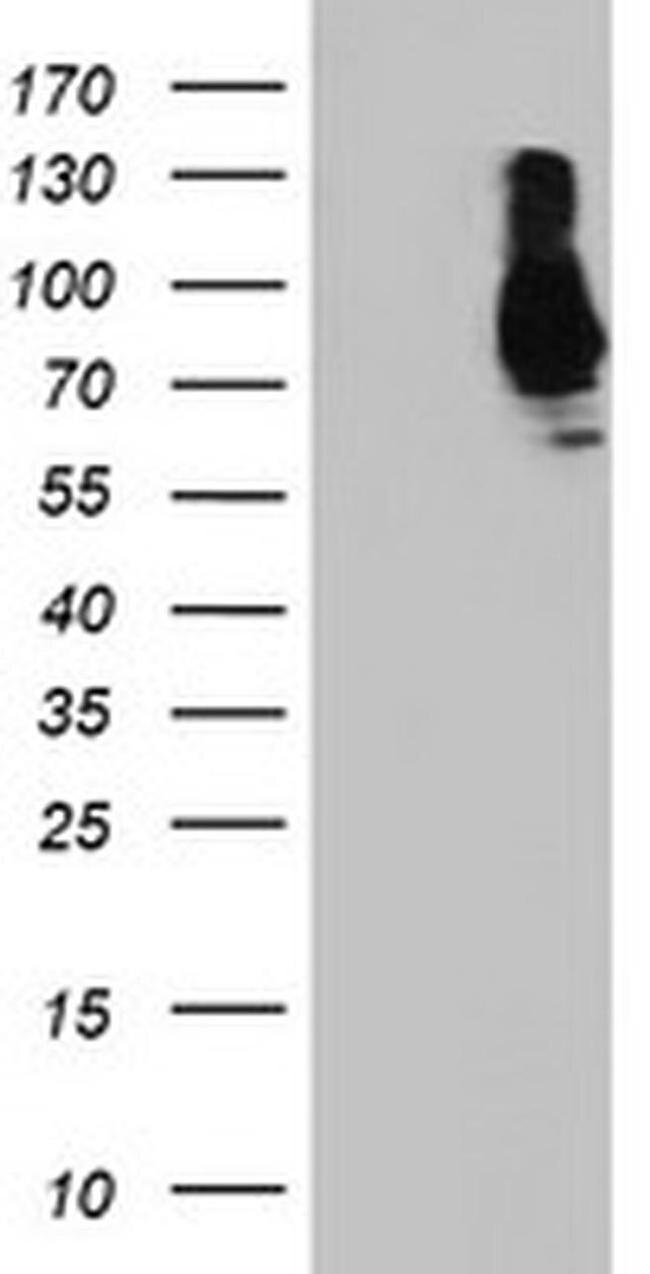 SAMHD1 Antibody in Western Blot (WB)