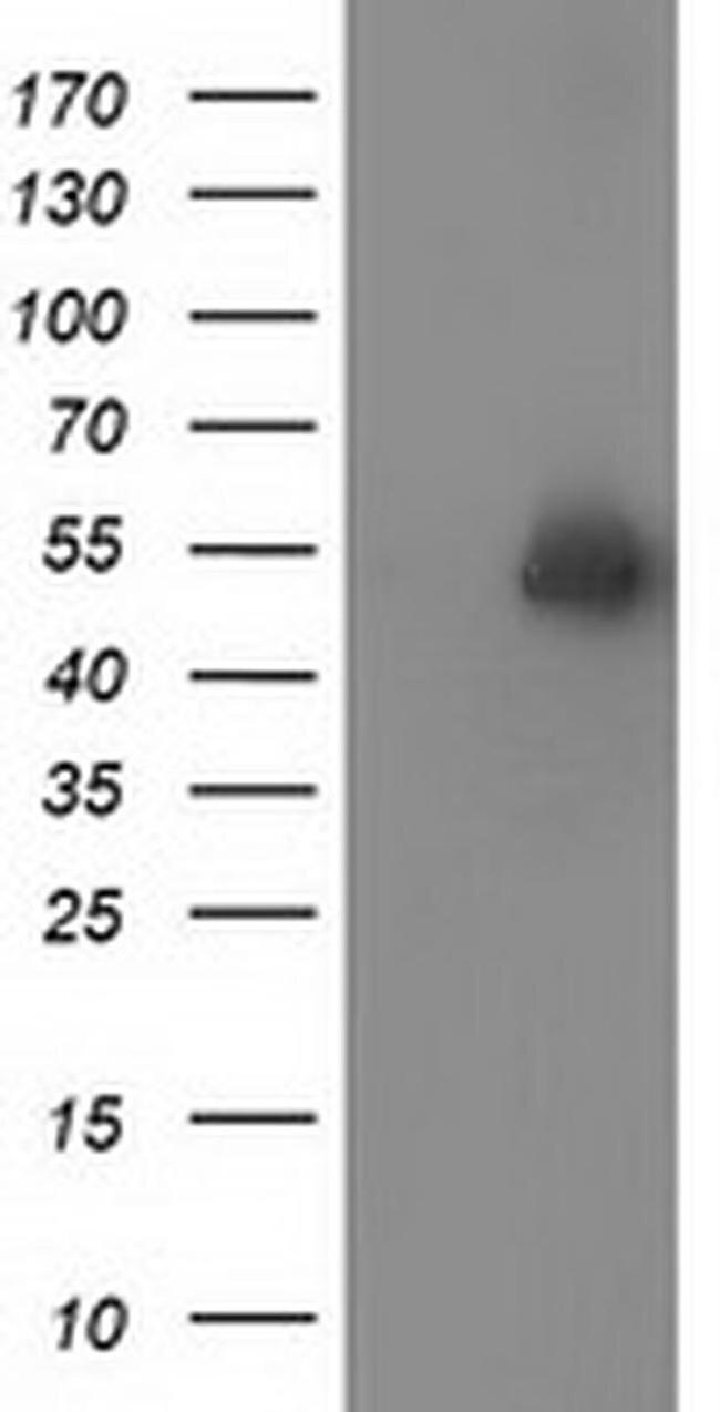 Syntrophin alpha-1 Antibody in Western Blot (WB)