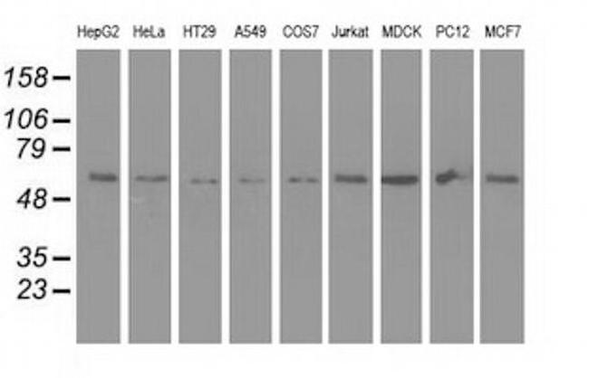 Syntrophin alpha-1 Antibody in Western Blot (WB)