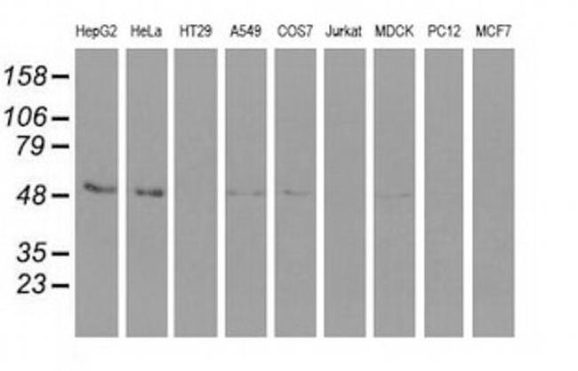 Syntrophin alpha-1 Antibody in Western Blot (WB)