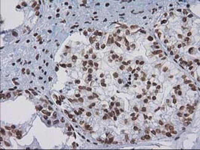 CTDSP1 Antibody in Immunohistochemistry (Paraffin) (IHC (P))