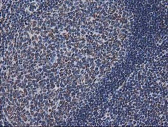 CTDSP1 Antibody in Immunohistochemistry (Paraffin) (IHC (P))