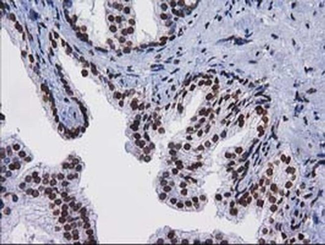 CTDSP1 Antibody in Immunohistochemistry (Paraffin) (IHC (P))