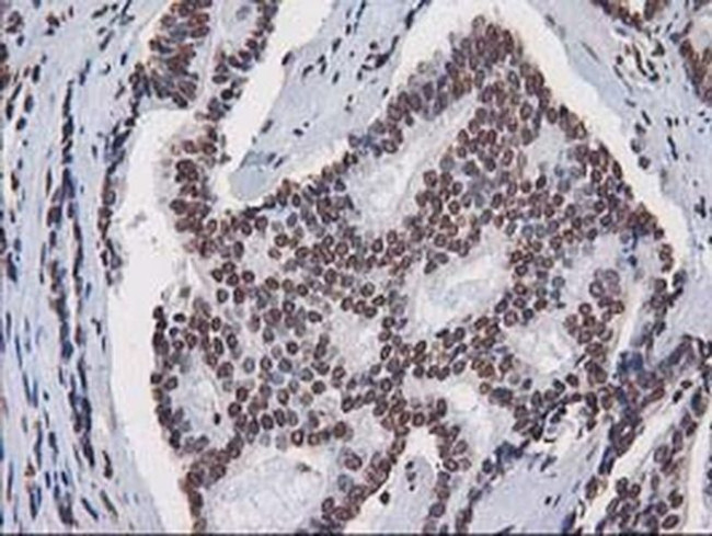 CTDSP1 Antibody in Immunohistochemistry (Paraffin) (IHC (P))