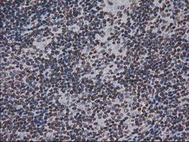 CTDSP1 Antibody in Immunohistochemistry (Paraffin) (IHC (P))