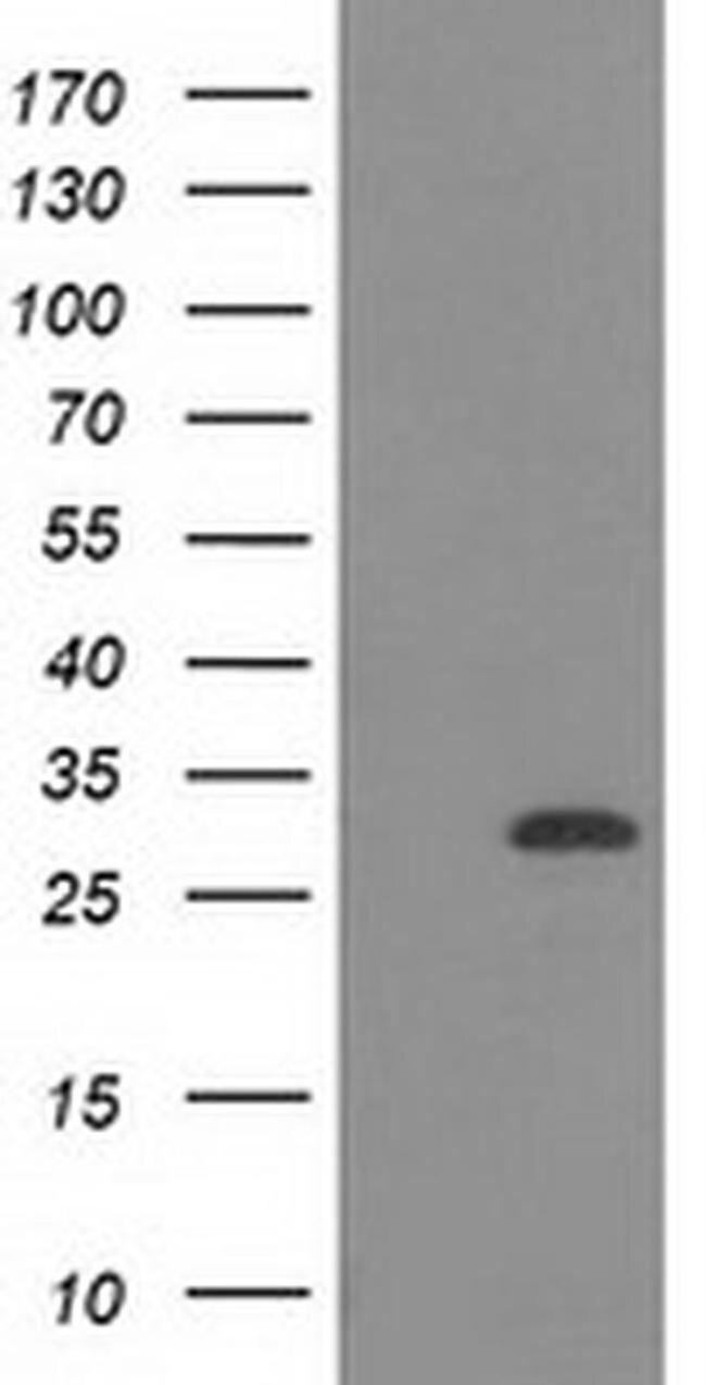 CTDSP1 Antibody in Western Blot (WB)