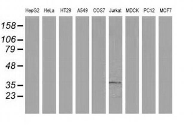 ACY3 Antibody in Western Blot (WB)