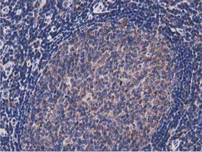 NUDT6 Antibody in Immunohistochemistry (Paraffin) (IHC (P))