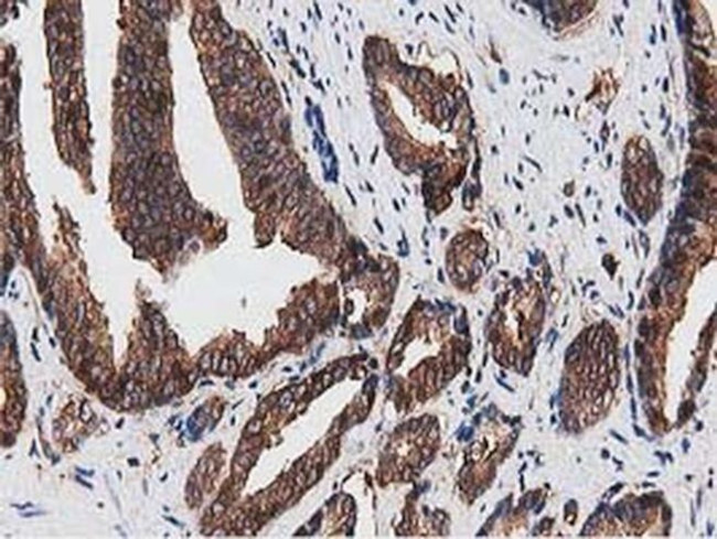 NUDT6 Antibody in Immunohistochemistry (Paraffin) (IHC (P))