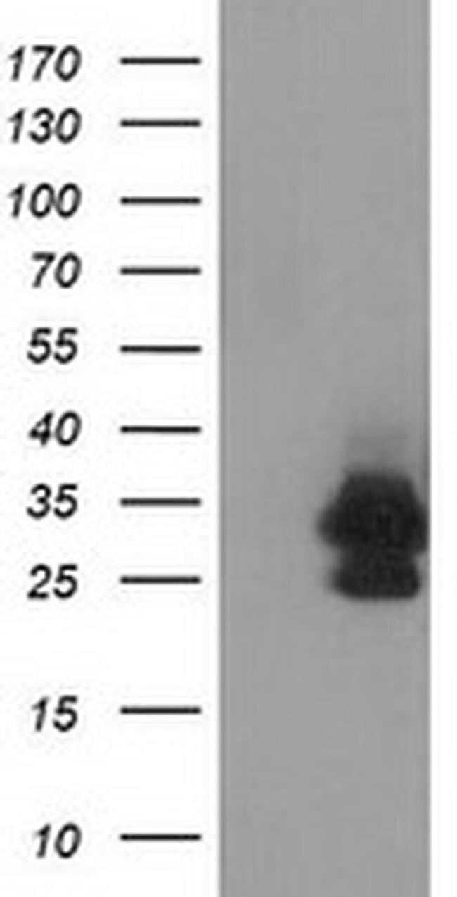 eIF4E2 Antibody in Western Blot (WB)