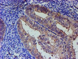 PNMA3 Antibody in Immunohistochemistry (Paraffin) (IHC (P))