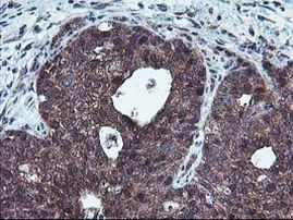 HDHD1 Antibody in Immunohistochemistry (Paraffin) (IHC (P))