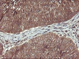 HDHD1 Antibody in Immunohistochemistry (Paraffin) (IHC (P))