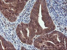 HDHD1 Antibody in Immunohistochemistry (Paraffin) (IHC (P))