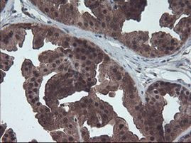 HDHD1 Antibody in Immunohistochemistry (Paraffin) (IHC (P))