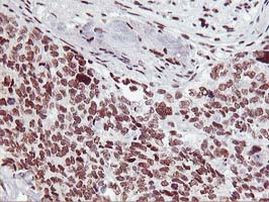 HOXC11 Antibody in Immunohistochemistry (Paraffin) (IHC (P))